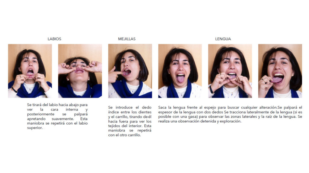 Autoexploración paso 2